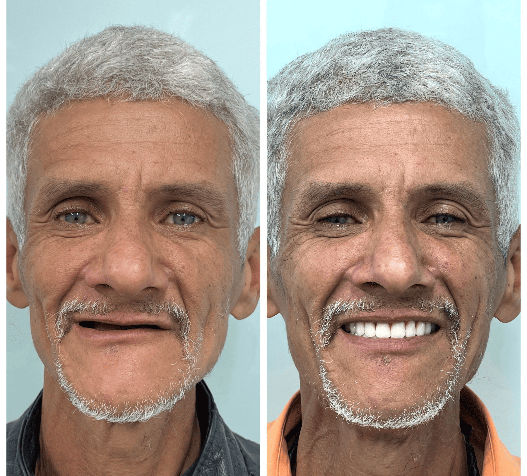 implante-dentario-belo-horizonte-dr-alysson-ramos-1-1.png