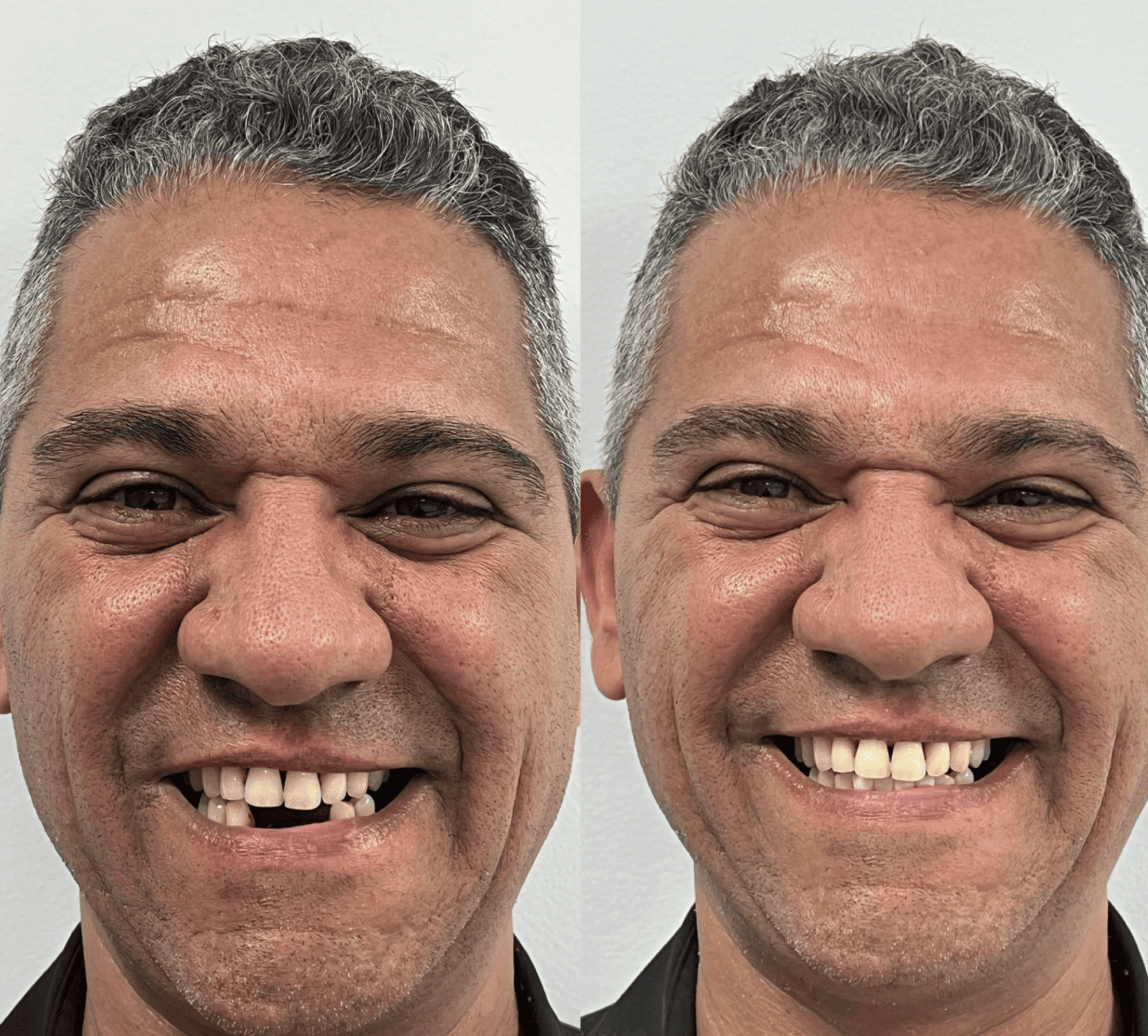 implante-dentario-belo-horizonte-dr-alysson-ramos-4-1.png